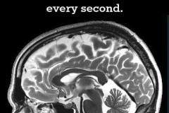 brain